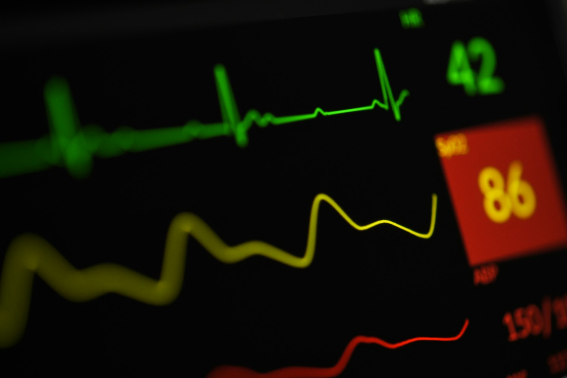 Understanding the Link Between Heart Rate Patterns and Chronic Stress